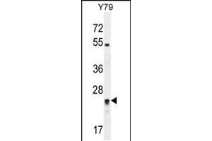 Western blot analysis in Y79 cell line lysates (35ug/lane). (DPCD anticorps  (AA 96-136))