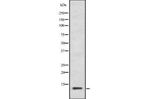 Western blot analysis of Calcitonin using K562 whole cell lysates