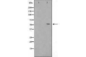Western blot analysis on HuvEc cell lysate using TINF2 Antibody,The lane on the left is treated with the antigen-specific peptide. (TINF2 anticorps  (Internal Region))