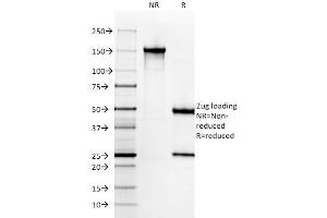 SDS-PAGE Analysis Purified SM-MHC Monoclonal Antibody (SMMS-1). (MYH11 anticorps)