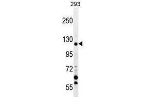 TRPM8 Antibody (Center) western blot analysis in 293 cell line lysates (35 µg/lane).