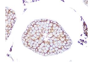 Immunohistochemistry of paraffin-embedded rat testis using RA Rabbit mAb (ABIN7269817) at dilution of 1:100 (40x lens). (RAB9A anticorps)