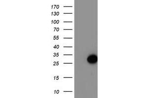 Western Blotting (WB) image for anti-ADP-Ribosylation Factor-Like 11 (ARL11) antibody (ABIN1496713) (ARL11 anticorps)