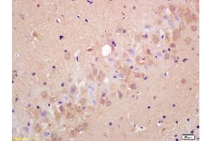 Formalin-fixed and paraffin embedded rat brain labeled with Anti-MRGX1/MRGPRC/SNSR Polyclonal Antibody, Unconjugated (ABIN718751) at 1:200 followed by conjugation to the secondary antibody and DAB staining. (MRGPRX1/3/4 (AA 21-120) anticorps)