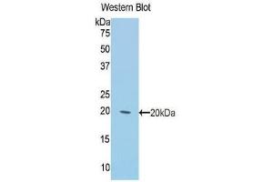 Western Blotting (WB) image for anti-Keratin 2 (KRT2) (AA 368-507) antibody (ABIN1859578)