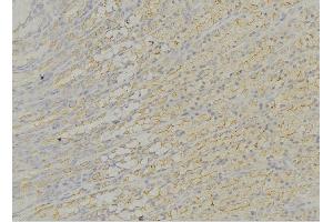 ABIN6276611 at 1/100 staining Human gastric tissue by IHC-P.
