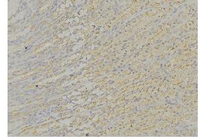 ABIN6276611 at 1/100 staining Human gastric tissue by IHC-P.