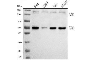 Western blot analysis of WHSC1/NSD2 using anti-WHSC1/NSD2 antibody (ABIN7600503).