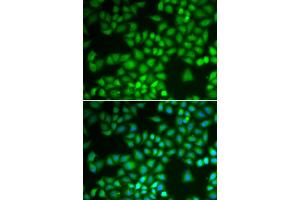 Immunofluorescence analysis of A549 cells using NFKB1 antibody (ABIN5974018). (NFKB1 anticorps)
