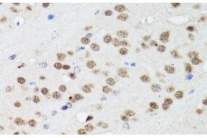Immunohistochemistry of paraffin-embedded Mouse brain using TIA1 Polyclonal Antibody at dilution of 1:100 (40x lens). (TIA1 anticorps)