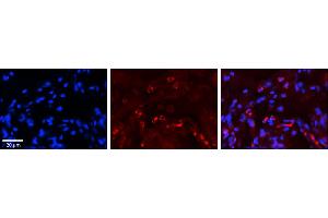 Rabbit Anti-GAA Antibody     Formalin Fixed Paraffin Embedded Tissue: Human Lung Tissue  Observed Staining: Cytoplasmic in alveolar type I cells  Primary Antibody Concentration: 1:100  Other Working Concentrations: 1/600  Secondary Antibody: Donkey anti-Rabbit-Cy3  Secondary Antibody Concentration: 1:200  Magnification: 20X  Exposure Time: 0.
