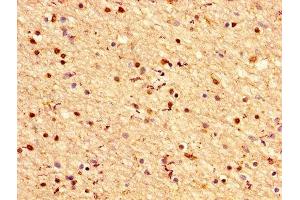 IHC image of ABIN7143857 diluted at 1:200 and staining in paraffin-embedded human brain tissue performed on a Leica BondTM system.