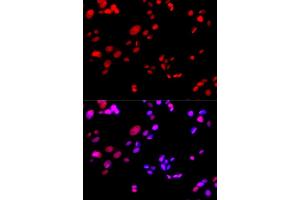 Immunofluorescence analysis of GFP-RNF168 transgenic U2OS cells using RPA2 antibody. (RPA2 anticorps  (AA 80-270))
