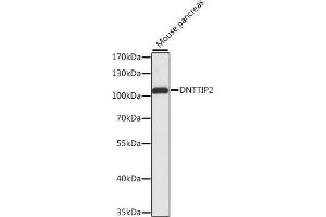 Western blot analysis of extracts of mouse pancreas, using DNTTIP2 antibody (ABIN7266732) at 1:1000 dilution. (DNTTIP2 anticorps  (AA 1-300))