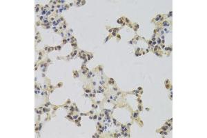 Immunohistochemistry of paraffin-embedded mouse lung using HDGF Antibody. (HDGF anticorps  (AA 1-240))