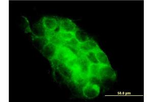 Immunofluorescence of monoclonal antibody to USP31 on A-431 cell.