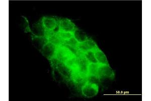 Immunofluorescence of monoclonal antibody to USP31 on A-431 cell. (USP31 anticorps  (AA 1254-1352))