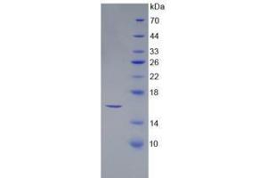 SDS-PAGE analysis of Human SFRP5 Protein. (SFRP5 Protéine)