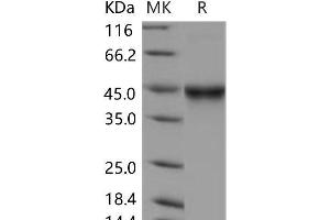 Western Blotting (WB) image for Interleukin 5 Receptor, alpha (IL5RA) (Active) protein (His tag) (ABIN7320031)