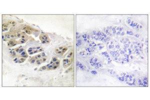 Immunohistochemistry (IHC) image for anti-Mammaglobin (Internal Region) antibody (ABIN1848654) (Mammaglobin anticorps  (Internal Region))