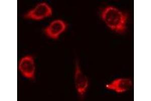 ABIN6275885 staining 293 cells by IF/ICC.