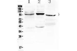Western blot analysis of ATF6 using anti- ATF6 antibody . (ATF6 anticorps  (C-Term))