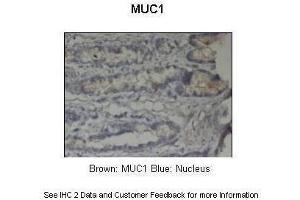 Sample Type :  Pig stomach  Primary Antibody Dilution :  1:500  Secondary Antibody :  Anti-rabbit-HRP  Secondary Antibody Dilution :  1:1000  Color/Signal Descriptions :  Brown: MUC1 Blue: Nucleus  Gene Name :  MUC1  Submitted by :  Dr. (MUC1 anticorps  (C-Term))