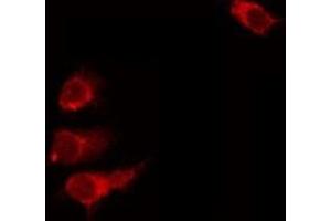 ABIN6275700 staining A549 by IF/ICC.