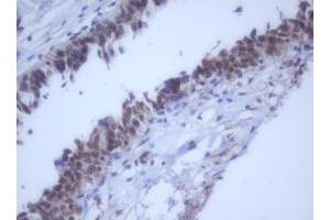 Image no. 7 for anti-DEAD (Asp-Glu-Ala-Asp) Box Polypeptide 59 (DDX59) (AA 1-303) antibody (ABIN1490728) (DDX59 anticorps  (AA 1-303))