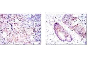 Immunohistochemistry (IHC) image for anti-Argininosuccinate Synthase 1 (ASS1) antibody (ABIN1105455) (ASS1 anticorps)
