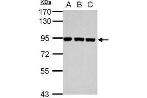 WB Image Sample (30 ug of whole cell lysate) A: Jurkat B: Raji C: K562 7.
