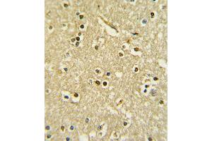 Formalin-fixed and paraffin-embedded human brain tissue with PAX6 Antibody , which was peroxidase-conjugated to the secondary antibody, followed by DAB staining.