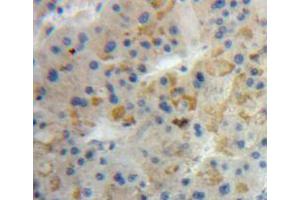 Used in DAB staining on fromalin fixed paraffin-embedded liver tissue (ANG anticorps  (AA 25-147))