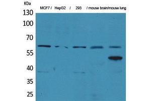 Western Blotting (WB) image for anti-Zinc Finger Protein 307 (ZKSCAN4) (Internal Region) antibody (ABIN3178345) (ZKSCAN4 anticorps  (Internal Region))