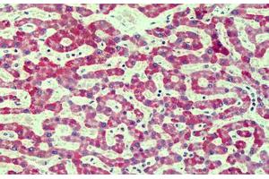 Human Liver: Formalin-Fixed, Paraffin-Embedded (FFPE)