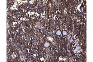 IHC analysis of KLHL12 using anti-KLHL12 antibody (ABIN7601009).
