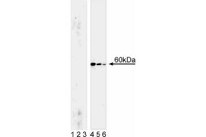 Western blot analysis for Akt (pS472/pS473). (AKT1 anticorps  (pSer472))