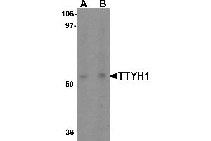 Western blot analysis of TTYH1 in Raji cell lysate with TTYH1 antibody at (A) 1 and (B) 2 µg/mL. (TTYH1 anticorps  (C-Term))