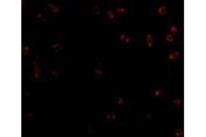 Immunofluorescence of Integrin alpha 4 in Jurkat cells with AP30436PU-N Integrin alpha 4 antibody at 2 μg/ml.