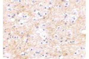 Immunohistochemical staining of human brain tissue using DLGAP3 polyclonal antibody  at 2. (DLGAP3 anticorps  (C-Term))