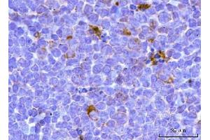 IHC analysis of TFEB using anti-TFEB antibody (ABIN7600648).
