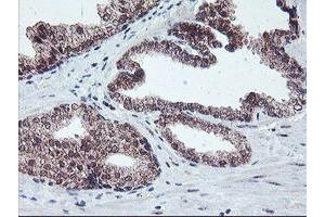 Image no. 1 for anti-Protein Phosphatase 1, Regulatory (Inhibitor) Subunit 15A (PPP1R15A) antibody (ABIN1498364)