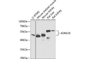 Western blot analysis of extracts of various cell lines, using B Antibody (ABIN6134019, ABIN6136597, ABIN6136598 and ABIN6224629) at 1:1000 dilution. (ADRA2B anticorps  (AA 1-100))