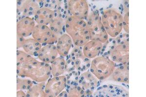 Used in DAB staining on fromalin fixed paraffin-embedded testis tissue (HSPA2 anticorps  (AA 1-633))