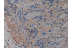 Detection of ABCA1 in Mouse Stomach Tissue using Polyclonal Antibody to ATP Binding Cassette Transporter A1 (ABCA1)