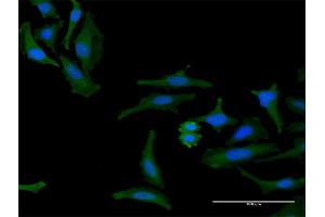 Immunofluorescence of purified MaxPab antibody to FAM60A on HeLa cell. (FAM60A anticorps  (AA 1-221))