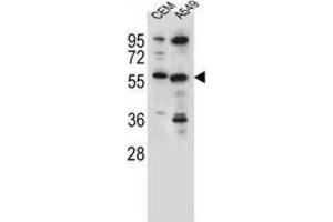Western Blotting (WB) image for anti-Cysteine Sulfinic Acid Decarboxylase (CSAD) antibody (ABIN2996373) (CSAD anticorps)