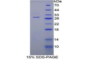 SDS-PAGE analysis of Rat WARS Protein. (WARS Protéine)