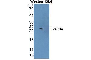Western blot analysis of the recombinant protein. (ANGPTL4 anticorps  (AA 228-389))
