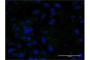 Immunofluorescence of monoclonal antibody to APOC3 on HeLa cell.